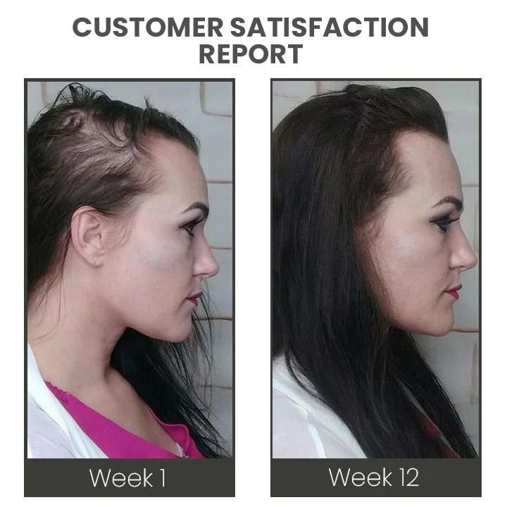 Hair Stimulating Spray Max 60 ml Pack of 2