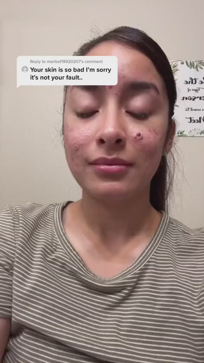 Snail 96 Mucin Power Essence 100 Ml Each  Pack of 2